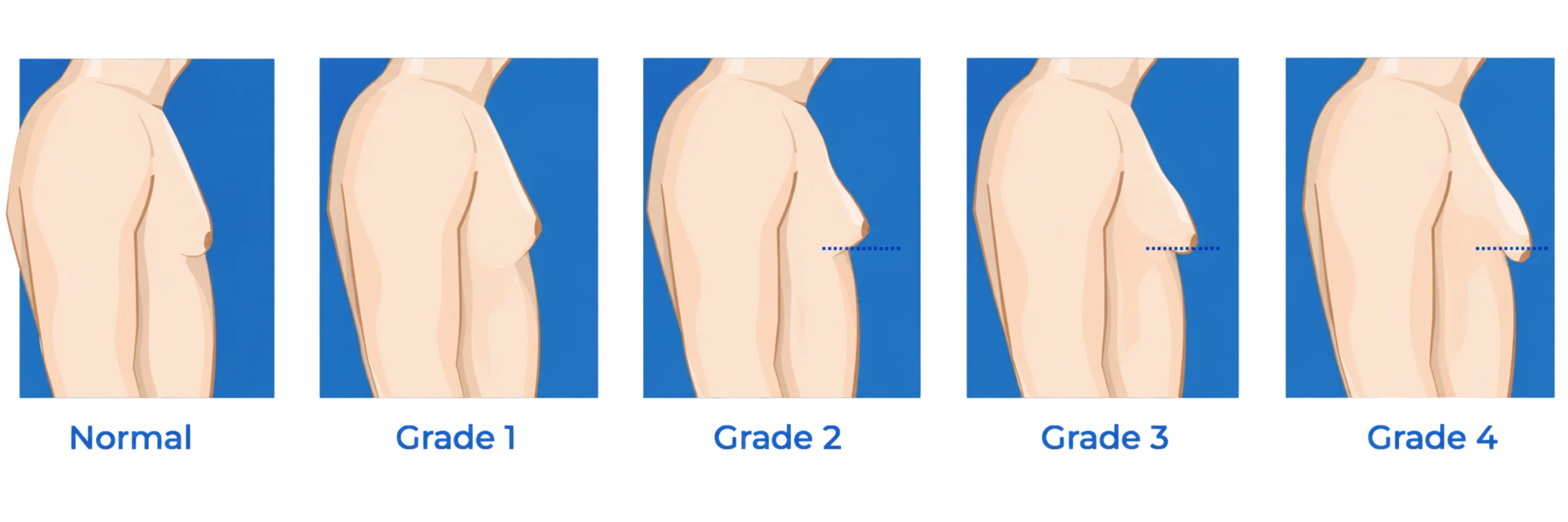 Grading-Classification-System