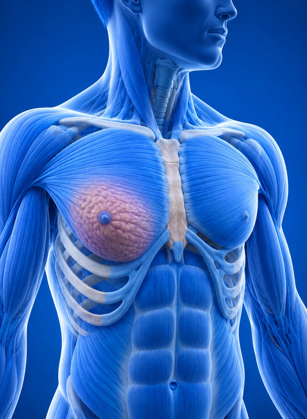 Male chest anatomy illustration showing breast gland enlargement