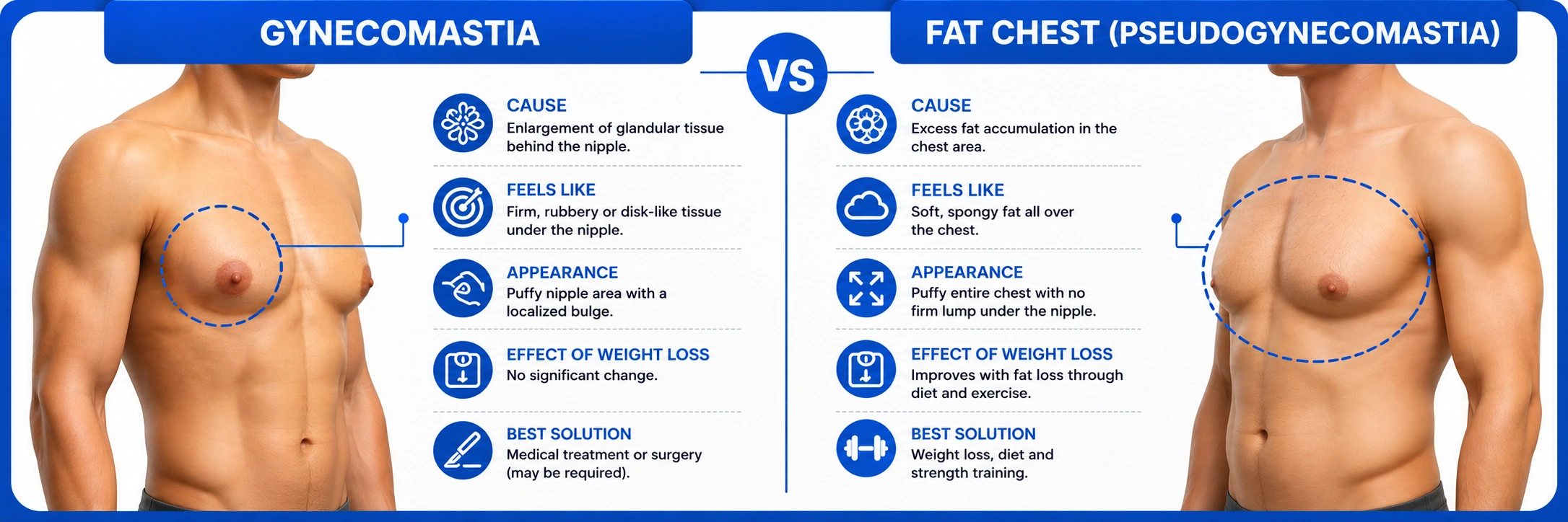Gynecomastia vs Fat Chest Comparison Infographic (1)
