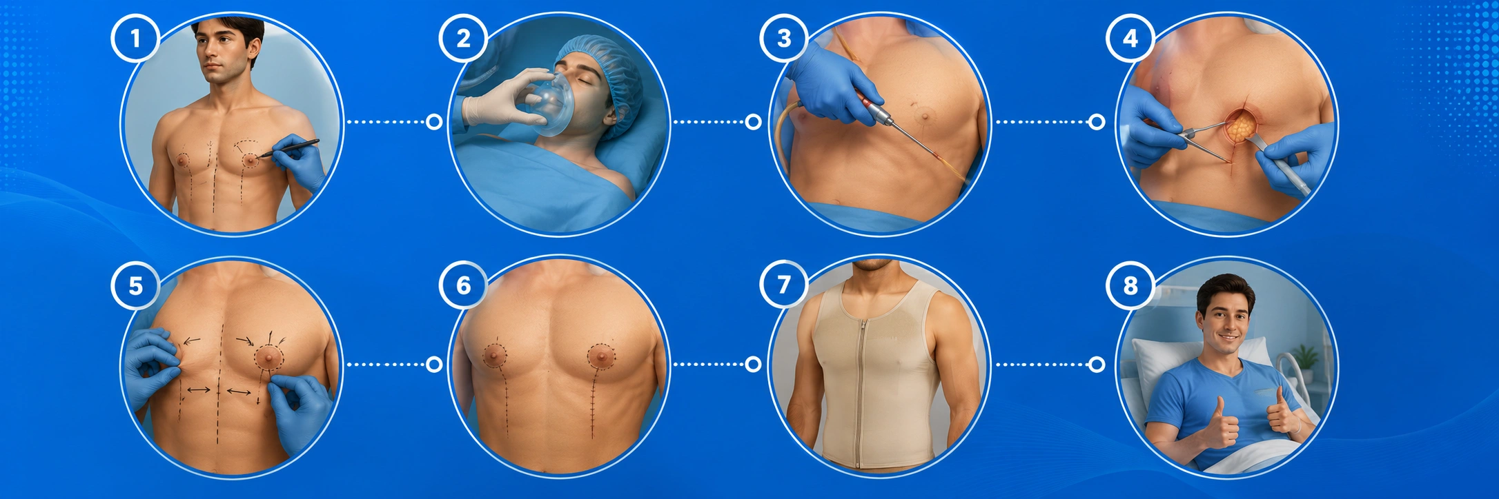 Surgeon performing gynecomastia correction procedure